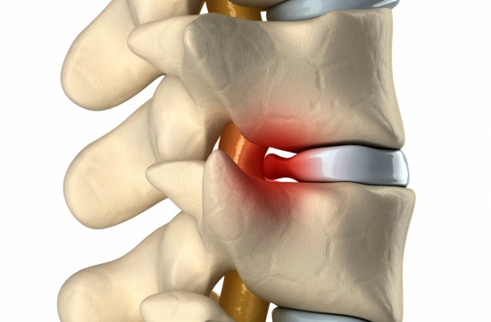 Osteopatia